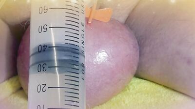 Perverted guy injects saline in his scrotum to make it larger