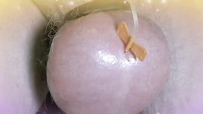 Perverted guy injects saline in his scrotum to make it larger
