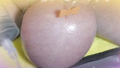 Perverted guy injects saline in his scrotum to make it larger