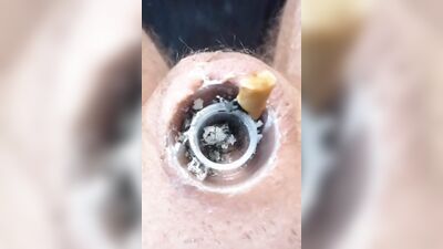 Naughty dude uses his micropenis as an ashtray while smoking