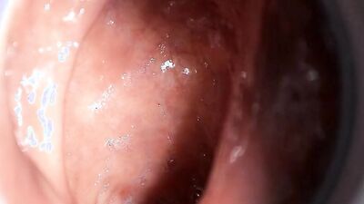 Close-up video of a chap stretching his pinky hole