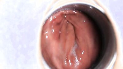 Close-up video of a chap stretching his pinky hole