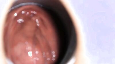 Close-up video of a chap stretching his pinky hole