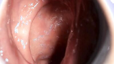 Close-up video of a chap stretching his pinky hole