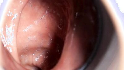 Close-up video of a chap stretching his pinky hole