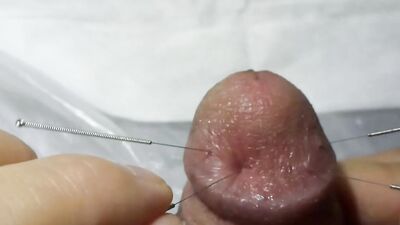 CBT needling penis