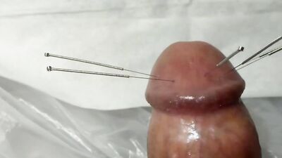 CBT needling penis
