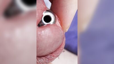 Sounding with a close up cum load through penis plug