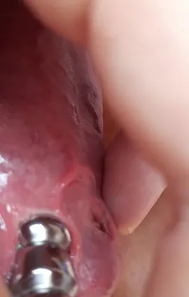 penis plug video AIESI® Gleitgel Steril für Katheter und Krankenhauseingriffe  Einzeldosis-Beutel 5 gramm LUBEGEL (Packung mit 100 stück) : Amazon.de:  Drogerie & Körperpflege main image 0
