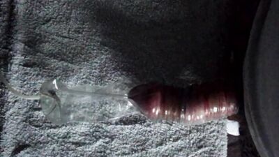 Hairy Cock And Balls With Rubber Bands And Condom Vacuum Suck Play With Juice Bottle