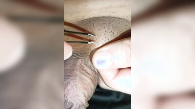 This is called penis hair pulling, and it’s very painful (A Hao)