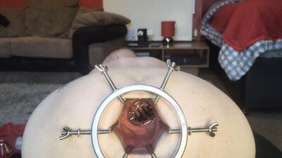 Both holes stretched ft David Anderson