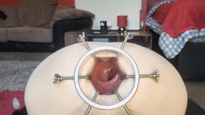 Both holes stretched ft David Anderson