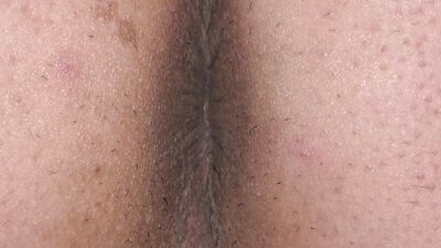 Man's Butt Hole Imagesvideos