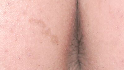 Man's Butt Hole Imagesvideos
