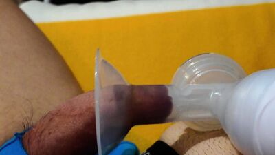 Trying out Breast Pump on my foreskin.