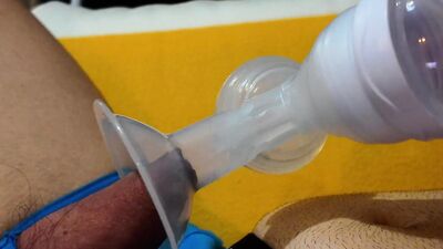 Trying out Breast Pump on my foreskin.