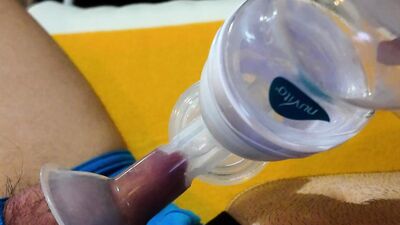 Trying out Breast Pump on my foreskin.