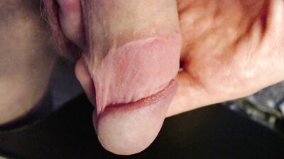 Endo show dick and ass