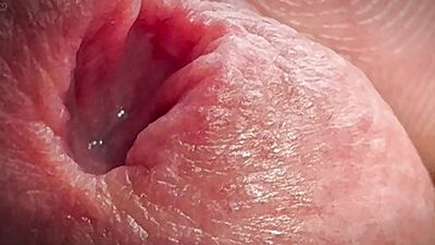 Peeing on the testicles