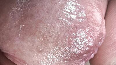 Penis hole gapes out of each other