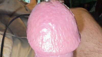 Estim and Acorn - Acupuncture!