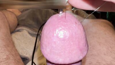 Estim and Acorn - Acupuncture!