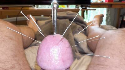 Estim and Acorn - Acupuncture!