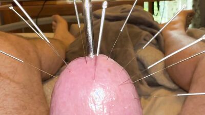 Estim and Acorn - Acupuncture!