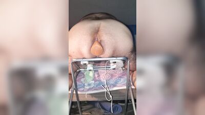 Anal Therapy at Home