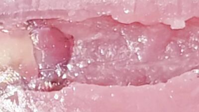 The guy fucks the masturbator hard and watches the sperm shoot inside