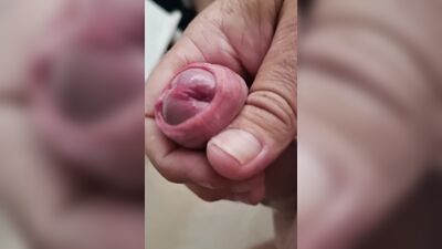 Uncut cock