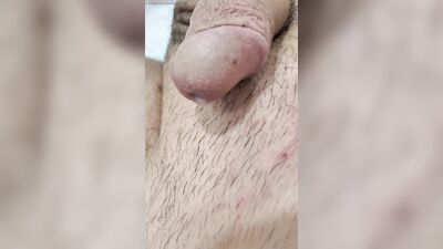 I treat my prostate and taste my own sperm