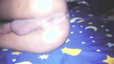 fisting anal gaping and prolapse