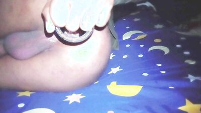 fisting anal gaping and prolapse